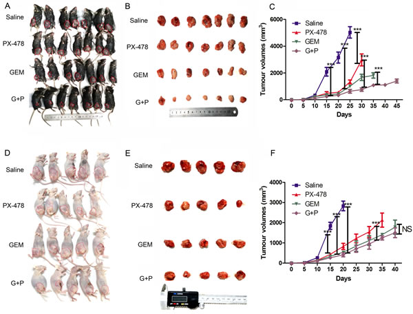 Therapeutic effects of Gem and/or PX-478 in immune-competent and immune-deficient mice.