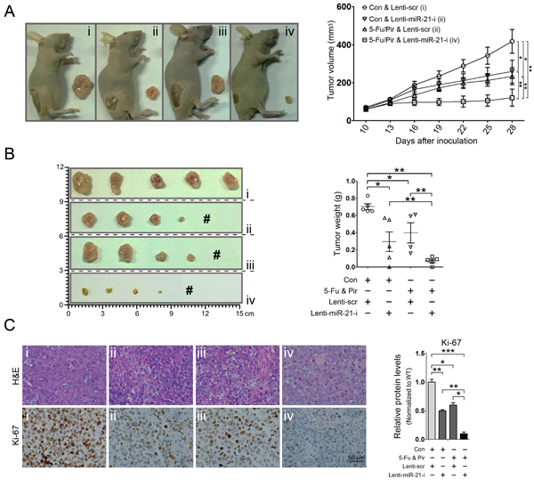 miR-21 suppression combined with 5-fluorouracil and pirarubicin treatment inhibits HCC xenograft growth.