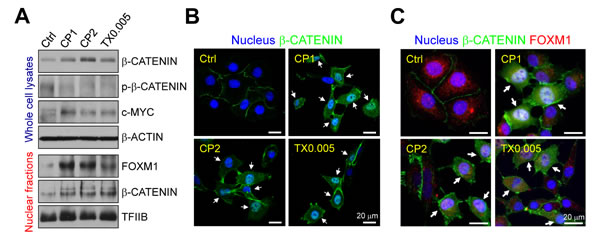 Chemoresistance promotes &#x3b2;-CATENIN expression, activation and nuclear localization.
