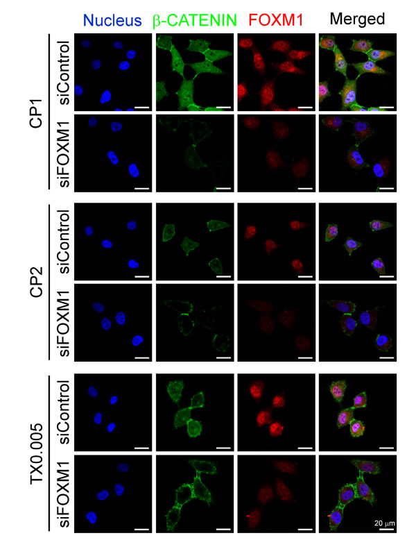 FOXM1 is essential for nuclear localization of &#x3b2;-CATENIN.