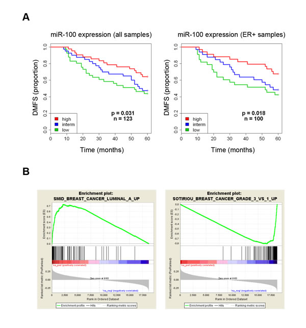 Low expression of miR-100 correlates with poor prognosis and high grade tumor signatures in breast cancer patients.