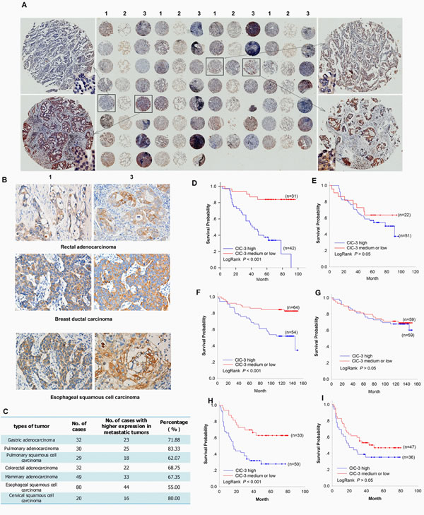 Association between ClC-3 Expression and Tumor Metastasis or Survival in Cancer Patients.