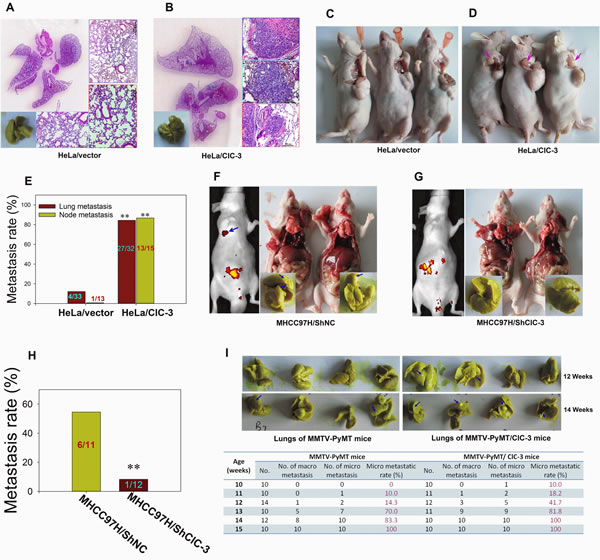 Overexpression or Knockdown of ClC-3 Promotes or Degrades Metastasis in Animal Models of Experimental Pulmonary and Spontaneous Metastases.