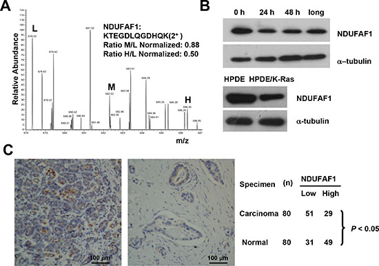 Suppression of NDUFAF1 expression by K-RasG12V and its low expression in pancreatic cancer tissues.