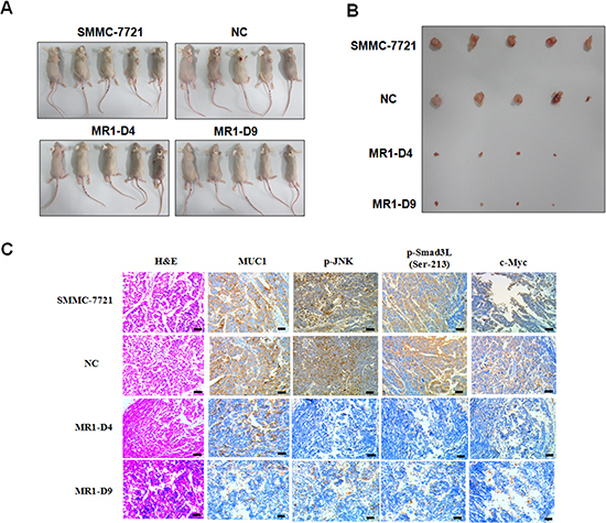 Knockdown of MUC1 suppresses tumor growth and JNK/pSmad3L/c-Myc pathway in mice.