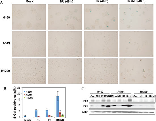 NU7441 enhanced IR-induced senescence in NSCLC cells.