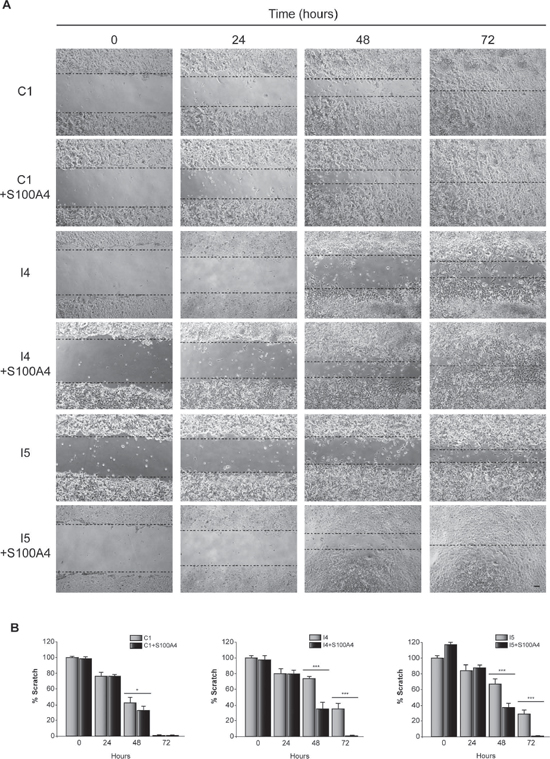 Effect of C/EBP&#x03B2; and S100A4 on GL261 cells motility.