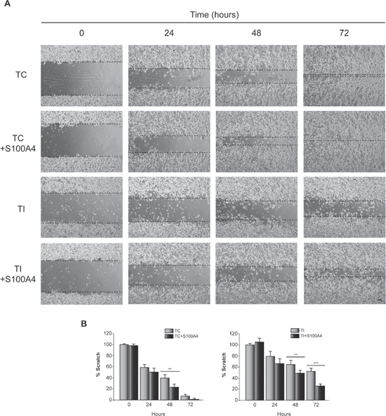 Effect of C/EBP&#x03B2; and S100A4 on T98G cells motility.