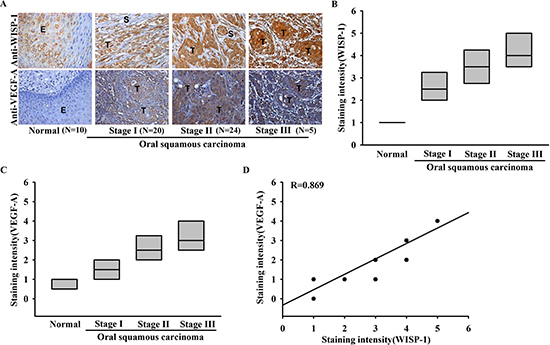 Clinical significance of WISP-1 and VEGF-A in specimens from patients with OSCC.