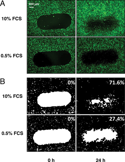 Automatization of the endothelial wound closure assay.