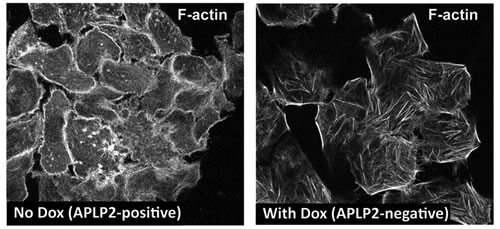 APLP2 down-regulation alters the morphology of the actin cytoskeleton.