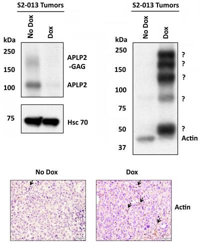 Tumors from mice implanted with S2-013-APLP2-shRNA orthotopic pancreatic tumors and then given Dox had a lower amount of actin monomers, but had an increased level of high molecular weight, covalently linked complexes containing actin.