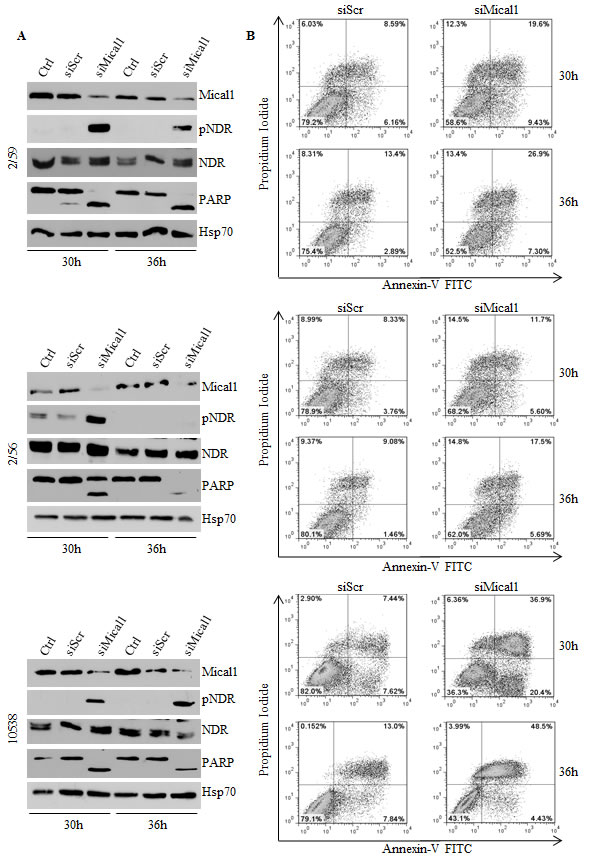 Silencing Mical1 induces apoptosis.