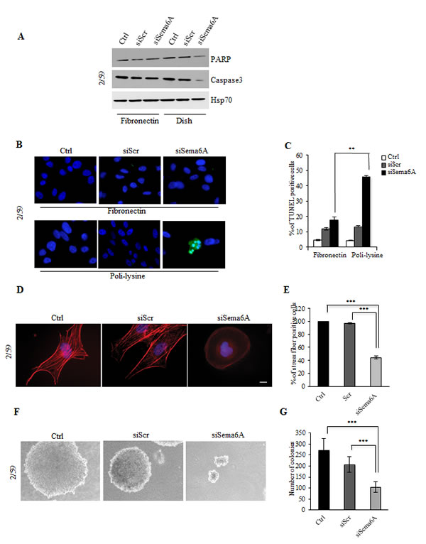 Interference with Sema6A expression in BRAF 2/59 cells induces cytoskeletal remodeling and inhibits anchorage-independent growth.