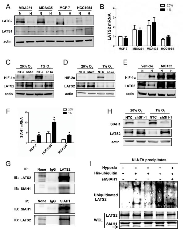 Analysis of LATS2 expression.