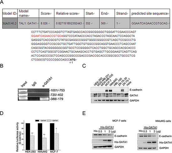 GATA1 binds to E-cadherin promoter and down-regulates E-cadherin.