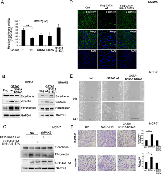 PAK5-mediated GATA1 phosphorylation regulates EMT in breast cancer cells.