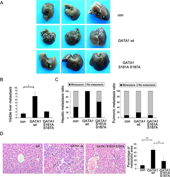 Phosphorylation of GATA1 enhances breast cancer cell metastasis in vivo.