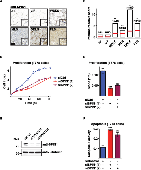 SPIN1 knockdown decreases proliferation and increases apoptosis of liposarcoma cells.