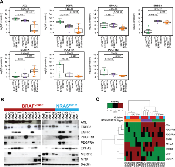 Expression pattern of selected RTKs in melanoma subtypes.