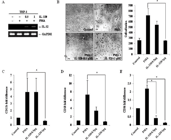 Ectopic expression of IL-32&#x03B8; inhibits differentiation of THP-1 cells.