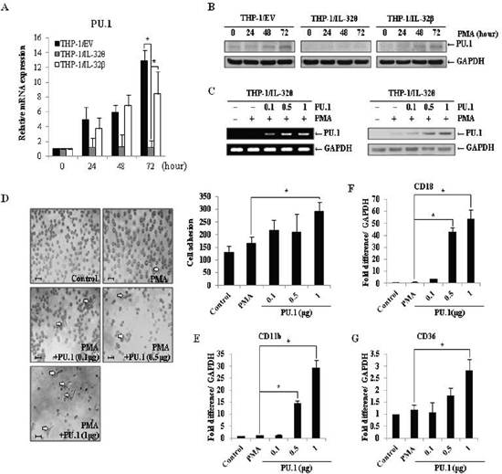 Expression of PU.1 rescues the IL-32&#x03B8;-induced differentiation defect.