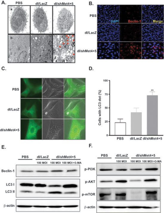 Induction of autophagy in glioma cells transduced with c-Met-specific shRNA-expressing Ad.