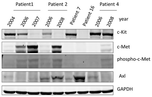 Western Blotting for c-Kit, c-Met, phosphor-c-Met, and AXL in GIST Patient Samples.