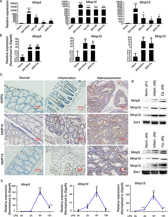 Mmp3, Mmp10, and Mmp13 are upregulated during CAC progression in mice.