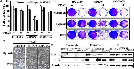 Lentiviral shRNA knock-down of PrPc sensitizes HCT116 cancer cells for TRAIL-induced colon cancer cell death.