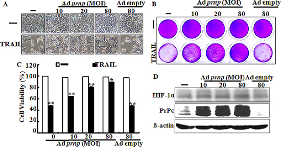 PrPc overexpression inhibits TRAIL-induced apoptosis.