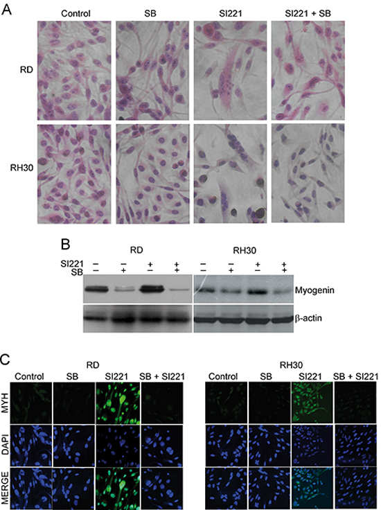 Effect of p38 MAPK inactivation on SFK inhibitor-induced RMS cell differentiation.