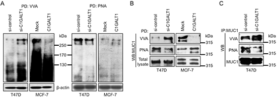 C1GALT1 regulates O-glycosylation of proteins in breast cancer cells.