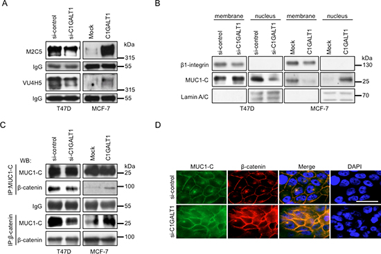 C1GALT1 regulates MUC1-N shedding and MUC1-C distribution in breast cancer cells.