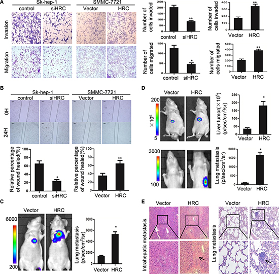 HRC promotes HCC cells migration and invasion in vitro and in vivo.