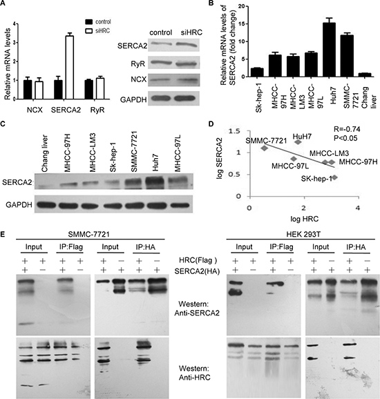 HRC increases intracellular calcium by inhibiting SERCA2.