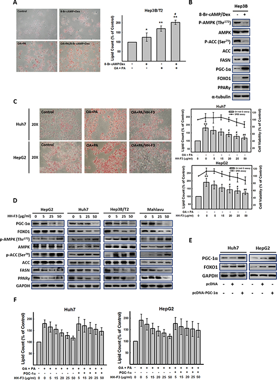 HH-F3 treatment decreases fatty acid synthesis in HCC.