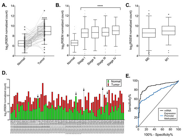 DCLK1 mRNA is overexpressed in the TCGA&#x2019;s clear cell RCC RNA-seq dataset.