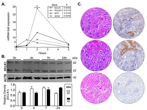 DCLK1 is induced under hypoxic conditions in RCC cells and is expressed in normal kidney.