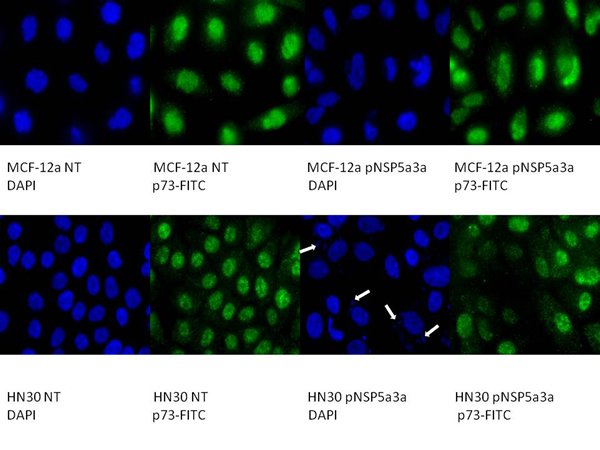 Immunostaining of HN30 and MCF-12a cells for p73 3 days post-transfection.