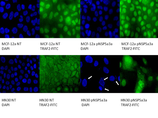 Immunostaining of HN30 and MCF-12a cells for TRAF2 3 days post-transfection.