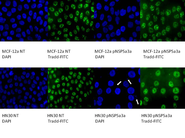 Immunostaining of HN30 and MCF-12a cells for TRADD 3 days post-transfection.