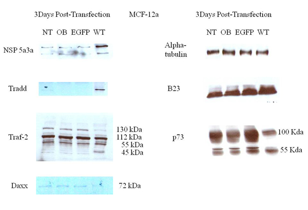 Western Blot analysis of total lysates from asynchronous MCF-12a cells 3 days post-transfection.