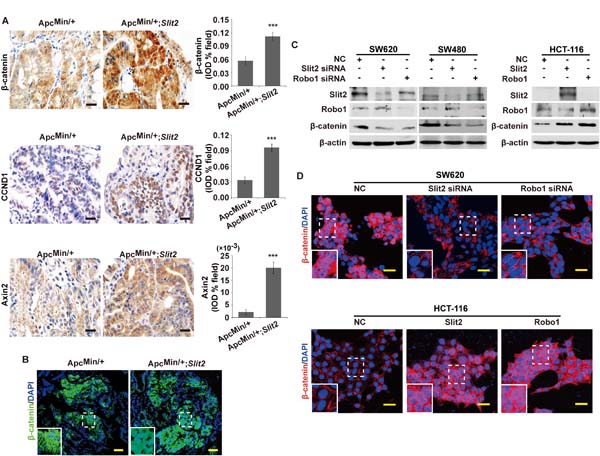 Activation of Slit2/Robo1 signaling led to an activation of Wnt/&#x3b2;-catenin pathway.