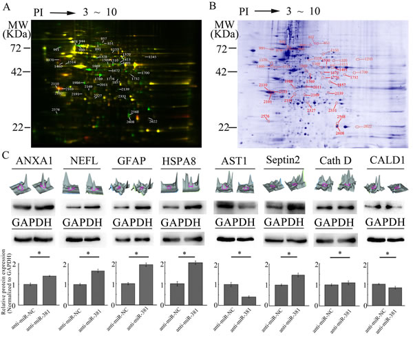Characterization of different proteins regulated by LNA-anti-miR-381 in GBM cells.