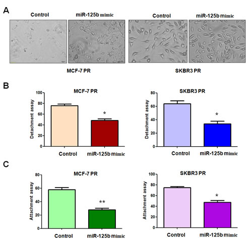 miR-125b mimc reduced the capacity of attachment and detachment in PR breast cancer cells.