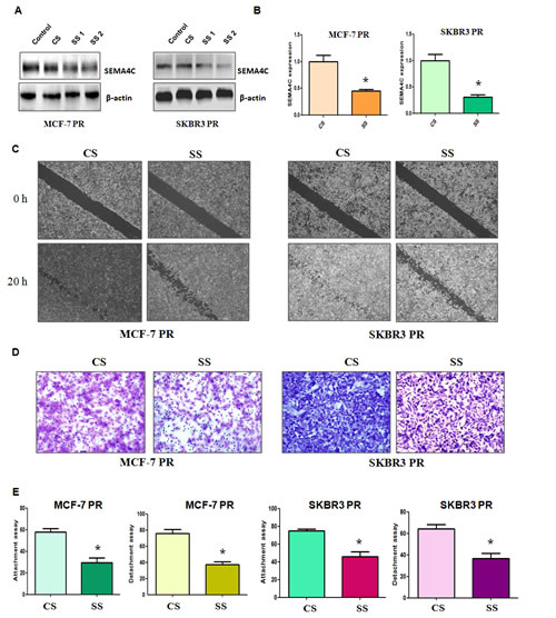 Depletion of Sema4C inhibited motility and invasion in PR cells.