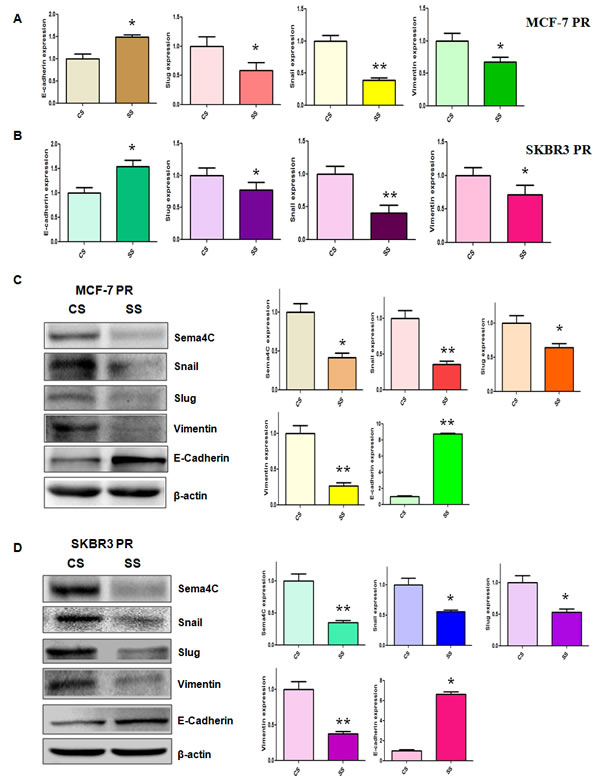 Depletion of Sema4C regulated the expression of EMT markers in PR cells.