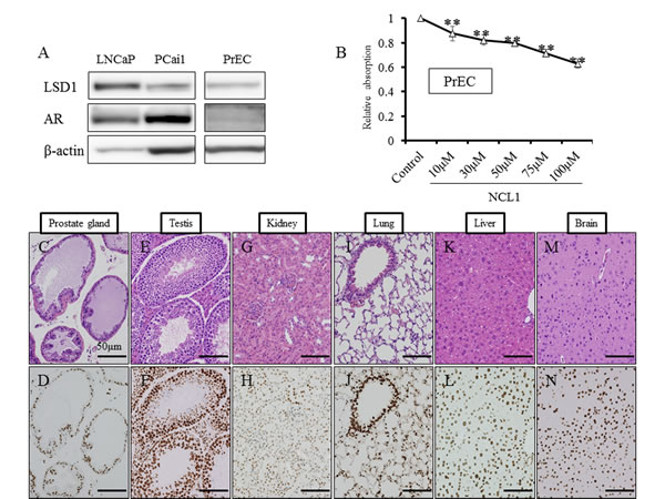 NCL1 treatment in normal prostate cell line, PrEC, and immunohistochemical analyses of LSD1 in mouse tissue.