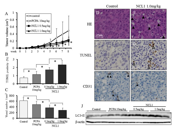 NCL1 treatment reduced subcutaneous prostate cancer xenograft tumor growth and induced apoptosis and autophagy